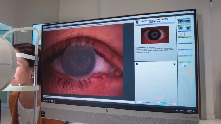 El Instituto Zaldivar ya trata el ojo seco por el exceso de pantallas con un tratamiento innovador